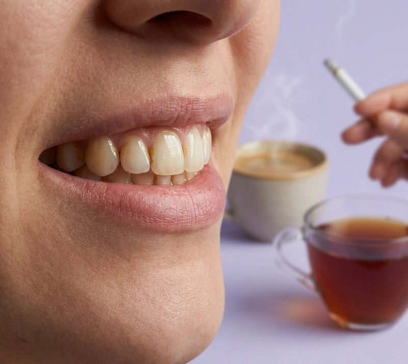 ¿Manchas de café, té o tabaco?