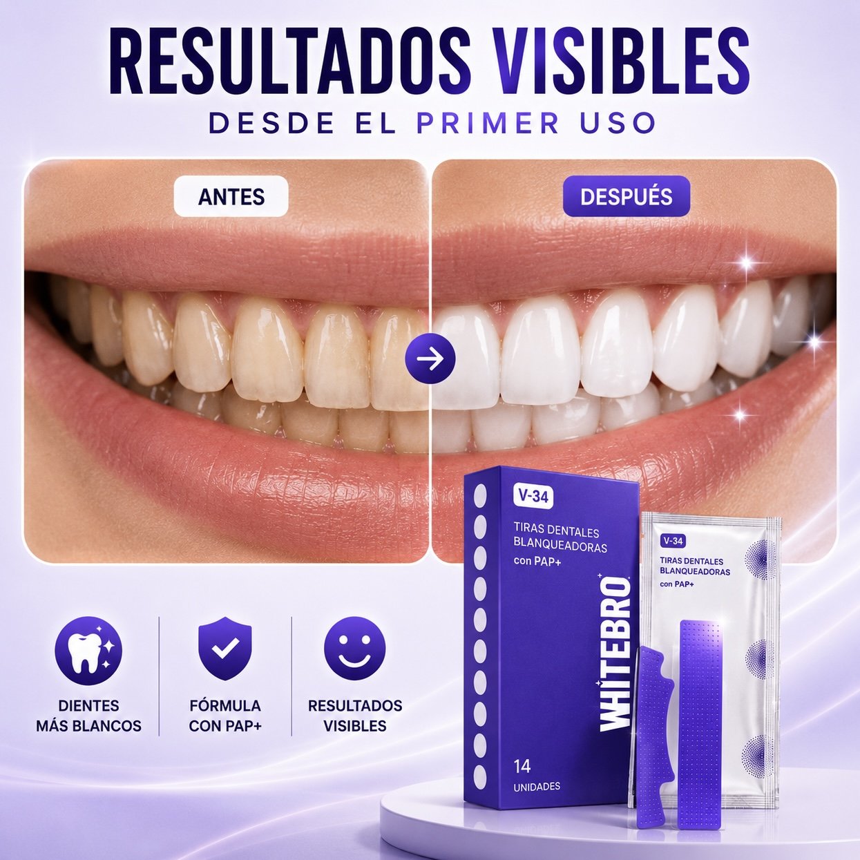Tiras Blanqueadoras Dentales V34 (14 Unidades) – Elimina el Amarillo y Blanquea tus Dientes en Casa - Quintéa
