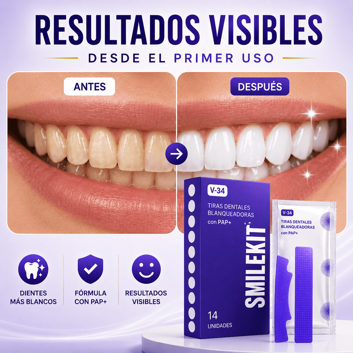 Tiras Blanqueadoras Dentales V34 – Elimina el Amarillo y Blanquea tus Dientes en Casa - Quintéa
